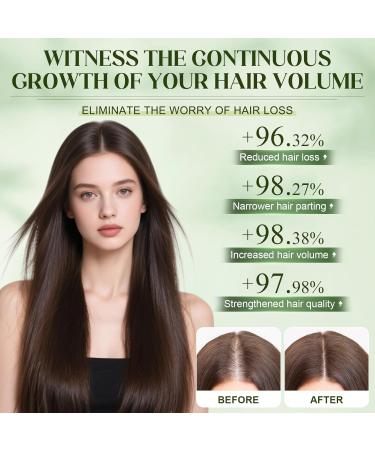 Alphainfuse Hair Regrowth System Alpha Infuse Repousse Cheveux Micro Infusion system Syst me de Repousse des Cheveux Densifie et Renforce les cheveux d s la Racine (5 ml x 6) - Buy Online on GoSupps.com