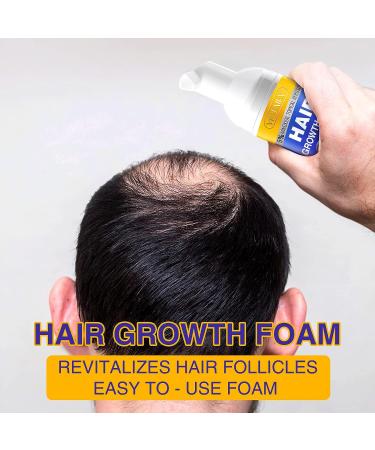5% Minoxidil Hair Growth Foam for Men and Women - Stop Thinning Hair - Hair Loss Treatment - Stronger, Thicker, Longer Hair - Buy Online on GoSupps.com