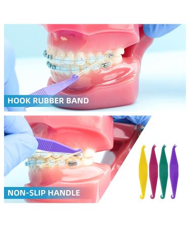 500 Pcs Orthodontic Elastic Rubber Bands 4.5 Oz 1/4 Size - Dental Rubber Bands for Teeth Gap, Braces, Dog Grooming, Braids, Tooth Gaps, Dreadlocks - Fox 4.5 Oz 1/4 - Buy Online on GoSupps.com