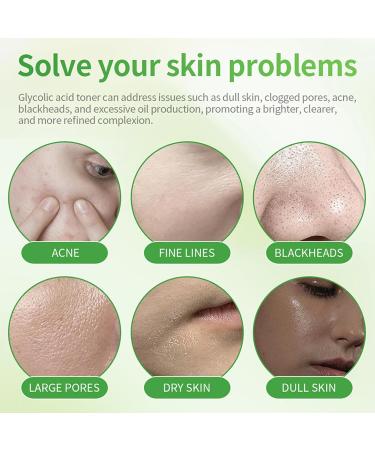 7% Glycolic Acid Toner Reduce Acnes Blemishes Pore Minimizer Gentle Exfoliating Face Toner Rejuvenate Moisturize Skin Improves Skin Brightness Suitable for Normal/Oily Skin - Buy Online on GoSupps.com