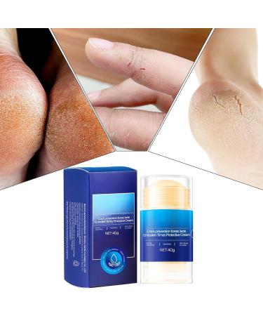 Stick for cracked heels moisturizing cream stick for feet caring for the skin care of women men seniors sports - Buy Online on GoSupps.com