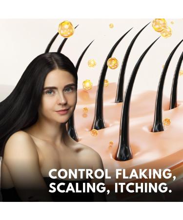 ABERA Alan Silver Serum Botanical Hydration for Sensitive Dry or Flaky Skin Plant-Based Face & Body Moisturizer with Black Ginger Neem Leaf & Cedar Oil 25ml 1 Box - Buy Online on GoSupps.com