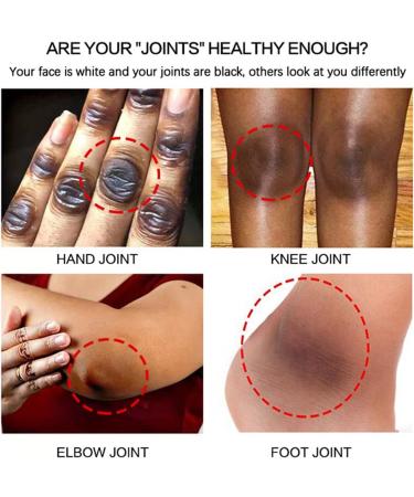 Dark Knuckle Whitening Serum Whitening Cream Knee Whitening Serum Joint Whitening Essential Oil Joint Brightening Cream Skin Lightening Serum for Und r rms Elbows Knees - Buy Online on GoSupps.com