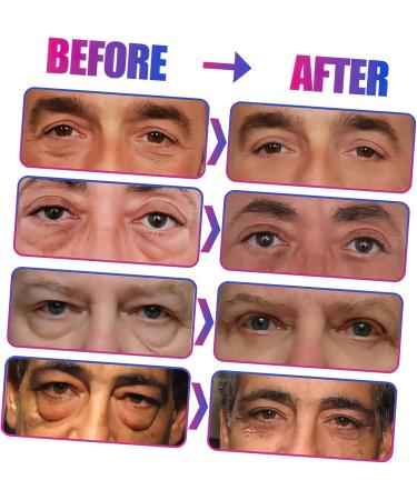 Healeved 2 soothing eye cream anti wrinkle skin care products Moisturizing Men's Eye Cream eyes Dark Circles Eye Cream eye bag cream Anti-wrinkle Eye Gel abs - Buy Online on GoSupps.com