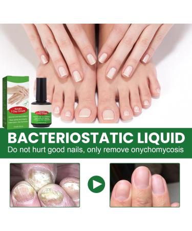 Keratin 3 Day Growth Nail Treatment & Strengthener Nail Strengthener for Damaged Nails Extra Strong Nail Growth Treatment Nail Repair Treatment Nail Strengthener and Growth Polish Nail Growth Serum - Buy Online on GoSupps.com