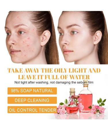 Deep Cleansing Facial Cleanser - Fades Acne Marks Shrinks Pores Moisturizes & Brightens Skin Gentle Daily Use(2PCS) - Buy Online on GoSupps.com