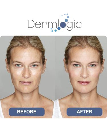 Dark Spot Corrector Cream - Fades & Repairs Sunspots, Acne Scars, Age Spots, and Freckles for Face & Body - Safe for All Skin Types - Buy Online on GoSupps.com