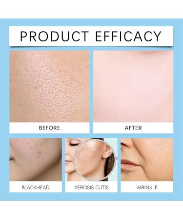 Gla-Mory Micro-Infusion System for Lips Gla-Mory Micro System for Face Hyaluronic Acid Serum Gla-Moryfacial System with Hydrating Serum Smooth Face Serum for Women Skincare Anti Aging Serum for Face - Buy Online on GoSupps.com