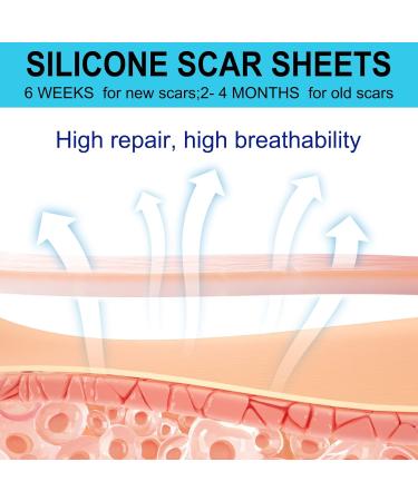 Silicone Scar Sheets 20Pcs - Professional Reusable Silicone Scar Tape for Surgical Scars, C-Section, Burn, Keloid & Acne Removal - Buy Online on GoSupps.com