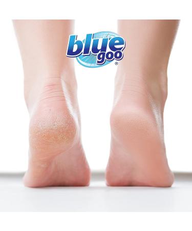 Blue Goo Intense Skin Softener with Emu Oil & Beeswax - 2 oz for Cracked Heels, Dry Hands, Calluses, Corns & Elbow Dryness Relief - Buy Online on GoSupps.com