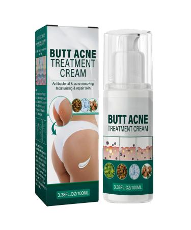 Cr me Nettoyante Acn Fesses et Cuisses Cr me pour les Boutons des Fesses Nettoyage Cr me Dissolvant de Boutons pour les Fesses 100ML 1PC