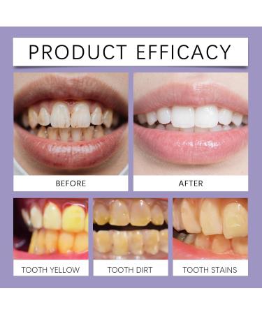 Purple Toothpaste - Teeth Whitening & Stain Removal Fresh Breath Daily Oral Care for Gum & Enamel(1PCS) 1 Fl Oz (Pack of 1) - Buy Online on GoSupps.com
