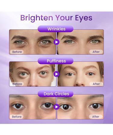 Eye Cream for Dark Circles and Puffiness Hydrating Under Eye Cream for Dark Circles Anti Aging Dark Circle Eye Cream for Fine Lines Wrinkles Firming Eye Contour 1.06 oz-BH222 - Buy Online on GoSupps.com