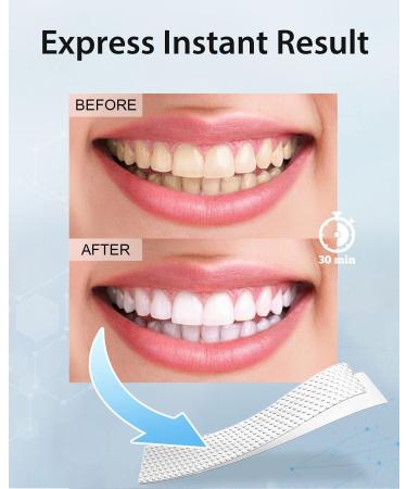 MySmile Teeth Whitening Strips - Non-Sensitive Kit, 28 Sets for 10 Shades Whiter, Removes Stains from Coffee, Wine & More - Buy Online on GoSupps.com