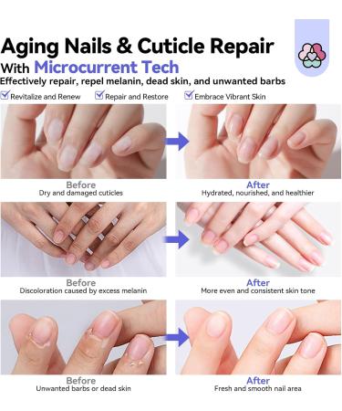 SAVILAND Cuticle Cream Microcurrent Tech: Repair Damaged Aging Nails 10 Natural Ingredients Vitamin E Plant Based Strengthener Ultra Rapid Absorption Nail Growth Treatment Pro-Salon Manicure Care - Buy Online on GoSupps.com