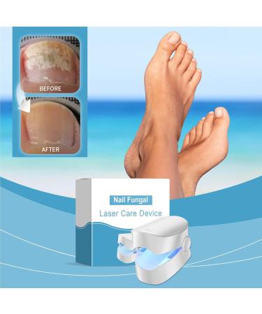 Nail Cleaning Device | Repair Fingernails & Toenails Nail Treatments Care Device - Versatile Professional Fingernails & Toenails Repair Device for Normal Abnormal Nails - Buy Online on GoSupps.com