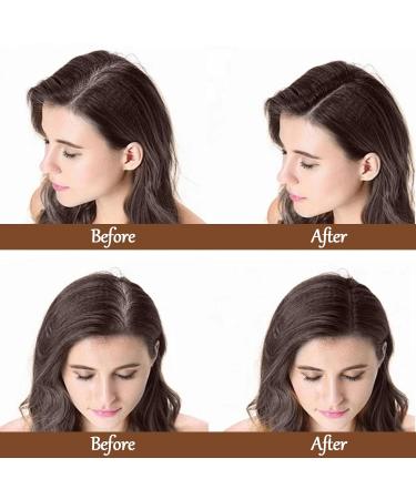 Hair Base Powder & Concealer - 4g Dark Coffee Hair Powder for Thinning Hair | Suitable for Men & Women | International Shipping - Buy Online on GoSupps.com