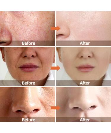 Coconut Hydrate Facial Moisturiser Coconut Oil Facial Moisturizer Coconut Hydration Facial Lotion Coconut Oil Body Lotion Coconut Water Facial Moisturizer Coconut Oil Formula Body Lotion - Buy Online on GoSupps.com