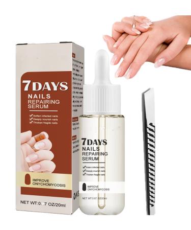 Nailgr 7 Days Nail growth and Strengthening Serum GFOUK 7 Days Nail Growth and Strengthening Serum Nail Growth And Strength Serum Nail Serum For Growth and Strength Nail Serum Repair Essence (1X 20ML)