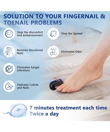 Nail Fungus Laser Treatment Device for Home Use | Effective Onychomycosis & Fungal Removal with 470nm Blue 660nm Red & 905nm Infrared Light - Buy Online on GoSupps.com