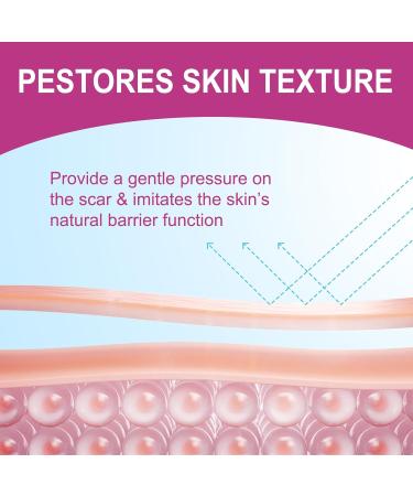 Silicone Scar Sheets & Tape Roll for Effective Scar Removal | Waterproof & Reusable Soft Silicone - 1.6x75 (1.9M) - Buy Online Now - Buy Online on GoSupps.com