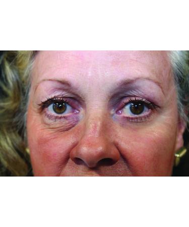 Rox Flawless Eyes by RX | Premium Eye Care for Radiant Skin | Shop Internationally Now - Buy Online on GoSupps.com