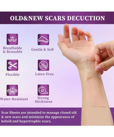 Silicone Scar Removal Tape - Fast Acting Soft Strips for Surgery & Injuries - 4 PCS - Buy Online on GoSupps.com