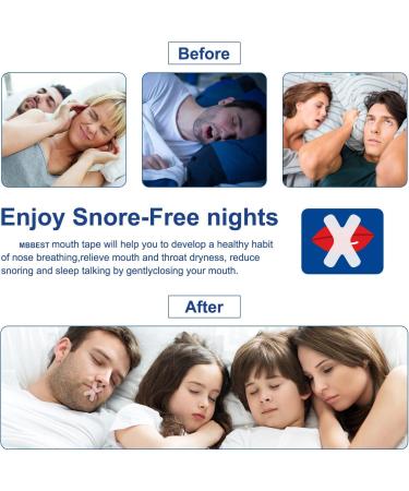 MBBEST 180 Pcs Mouth Tape for Nasal Breathing | Sleep Aid for Snoring Relief and Optimal Sleep | Improve Nasal Breathing for Comfortable Sleep - Buy Online on GoSupps.com