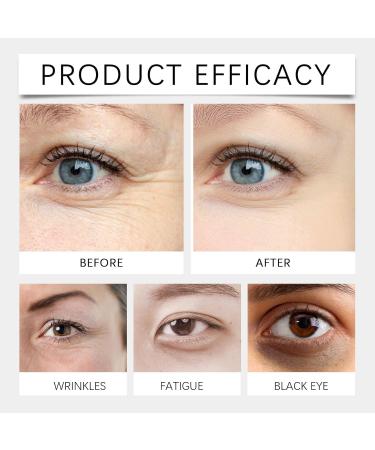 Lutein Eye Essential Oil 1.8ml Essential Oil Roller Balls Vc Lutein Eye Essential Oil Roller Eye Serum Oil (5PC) - Buy Online on GoSupps.com