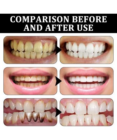 Effective Tooth Whitening Powder | Activated Carbon & Coal Toothpaste for Stain Removal & Fresh Breath - Buy Online on GoSupps.com