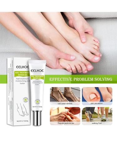2PCS Nail Repair Essence Cream - Restores Discolored/Damaged Nails - Toe Beauty Cream for Toenail Care - Buy Online on GoSupps.com