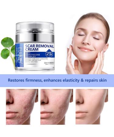 Uocasi Scar Removal Cream Scar Remover Treatment Butter Skin Repair Cream for New and Old Scars Effectively Repairs Facial Skin Cuts Stretch Marks Surgical Scars 50ML - Buy Online on GoSupps.com