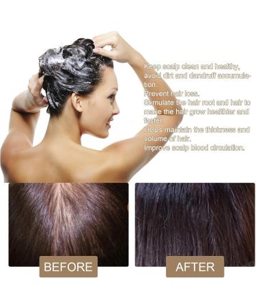  Pemarlis 100g Rice Shampoo Bar Shampoo Bar Natural Rice Soap For Thinning Hair And Hair Loss Effectively Promotes Hair Growth - Buy Online on GoSupps.com