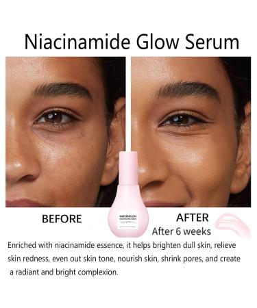 Watermelon Glow Niacinamide Serum | Hydrating Moisturizer with Hyaluronic Acid & Vitamin E - Brightening Face Care - Buy Online on GoSupps.com