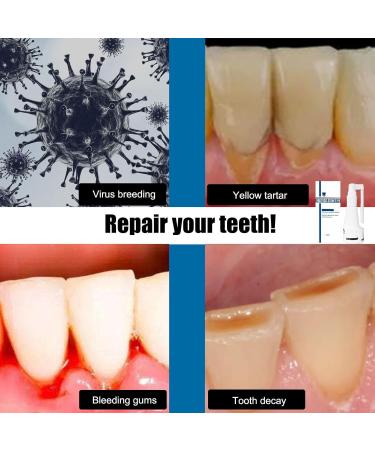 Mouth Shower Test Winner | Calculus-Free Deep Cleaning Foam & Stain Removal Tooth Spray - 30ml White - Buy Online on GoSupps.com