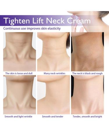 Neck Firming Cream | Tighten & Lift | Anti-Aging Neck Cream for Wrinkles & Even Skin Tone | Pro-Active Repair Complex - 1.7 OZ - Buy Online on GoSupps.com
