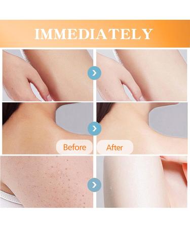 Turmeric Body Lotion - Remove Acne Dark Spots - Moisturizing Body Lotion for Dry Skin - Brightening Body Moisturizer Women to Improve Dull Skin - Body Skin Care Smooth Skin Deeply Moisturize Skin - Buy Online on GoSupps.com