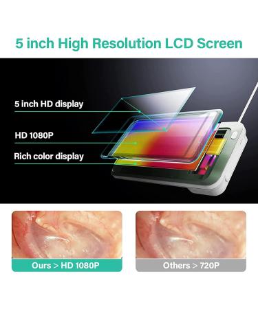 Otoscope Ear Wax Removal Kit 3.9mm HP 5 Inch Screen Digital Otoscope Handheld Visual Ear Cleaning Scope Endoscope Ear Scope for Adults Kids &Pets Green - Buy Online on GoSupps.com