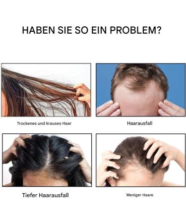 Hair oil 50 ml hair care oil hair growth oil natural hair growth oil essential hair growth oil hair care treatments with concentrated formula strengthens and repairs damage - Buy Online on GoSupps.com