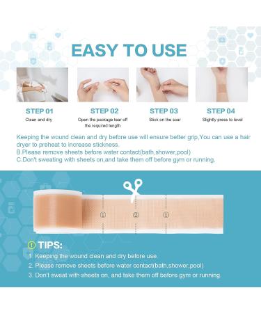 Medical Grade Silicone Scar Sheets Roll - 1.6 x 120 inches, 3M Brand - For C-Section, Surgery, Burn, Keloid, Acne - Reusable & Washable - Scar Removal Treatment - Buy Online on GoSupps.com