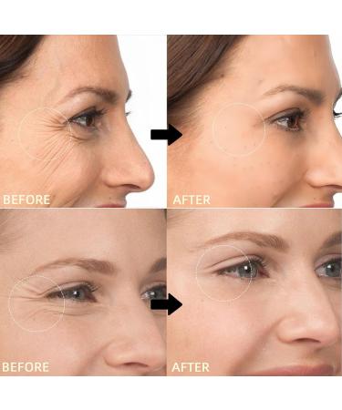 Revive Retinol Eye Cream with Peptide | Anti-Aging Treatment Reduces Wrinkles for Face and Neck Fine Lines Firms & Hydrates for All Skin Types | Boosts Collagen Improves Skin Texture | 1.35oz 2PCS - Buy Online on GoSupps.com