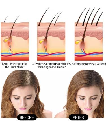  Utapossin Polygonum Multiflorum Shampoo 2 Pack Black Shampoo for Hair Growth Shampoo Anti Hair Loss Reduction Excessive Hair Loss Stimulation - Buy Online on GoSupps.com