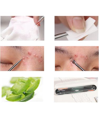 Curved Pimple Tweezers - 8pcs Pimple Popper Tools Blackhead Remover Kit - Curved Blackhead Remover Tweezers Blackhead Remover Comedone Extractor with Storage Box for Pimples - Buy Online on GoSupps.com