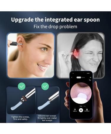 1080P HD Ear Wax Removal Kit - Ear Cleaner with Camera & Lights for iOS/Android | Complete Ear Cleaning Set with 8 Accessories - Buy Online on GoSupps.com