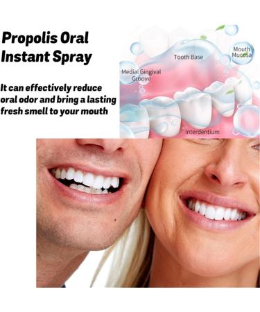 Propolis Oral Instant Treatment Spray - 2 Piece Set | Deep Cleaning Mouthwash & Refreshing Breath | Furzero Propolis Oral Health - Buy Online on GoSupps.com