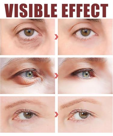 Caffeine Eye Serum Anti-Aging Caffeine Solution 5%-Caffeine Eye Serum Eye Serum For Dark Circles Hydrating Under Eye Serum Instant Eye Serum Anti Aging Anti Wrinkles & Eye Bag Quick Absorb-30ml - Buy Online on GoSupps.com
