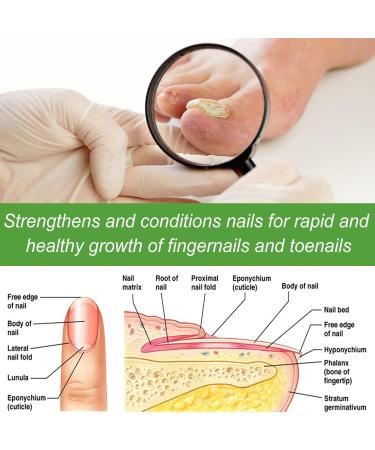 Repairing Treatment for Damaged Nails 10ml Roll-On Stick for Weakened Toenails - Nourishing Hardener for Fingernails and Toenails - Home or Salon Use - Buy Online on GoSupps.com