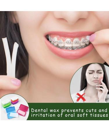 10 Pieces Orthodontic Wax for Braces - Colors & Flavors | Dental Relief Wax for Comfort - Buy Online on GoSupps.com