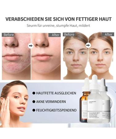 3PC Facial Serum Set for Women | Niacinamide 10% + Zinc Hyaluronic Acid 2% + B5 Retinol Serum | Acne & Pore Reduction Skincare Kits - Buy Online on GoSupps.com