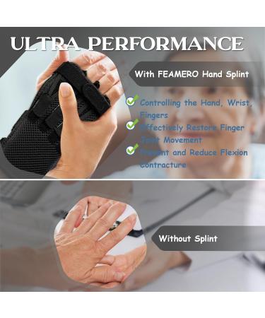 Adjustable Radial Nerve Palsy Splint - Finger Extension Brace for Drop Wrist & Injury Relief | Left & Right Hand Fit - Buy Online on GoSupps.com